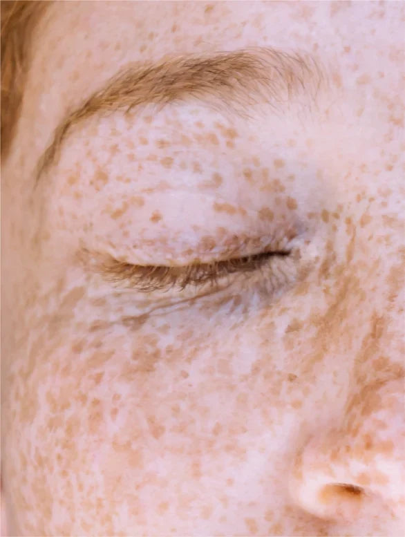 Vitamin C Serum-2